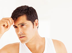 Male Hair Loss Prevention and Treatment