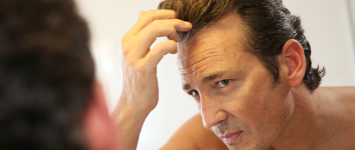Male Hair Loss Treatment London | Diagnosis and Care